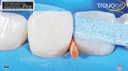 Kit discos de pulido Zenit Flex Snap On (160 discos + mandril + 20 strips) PD
