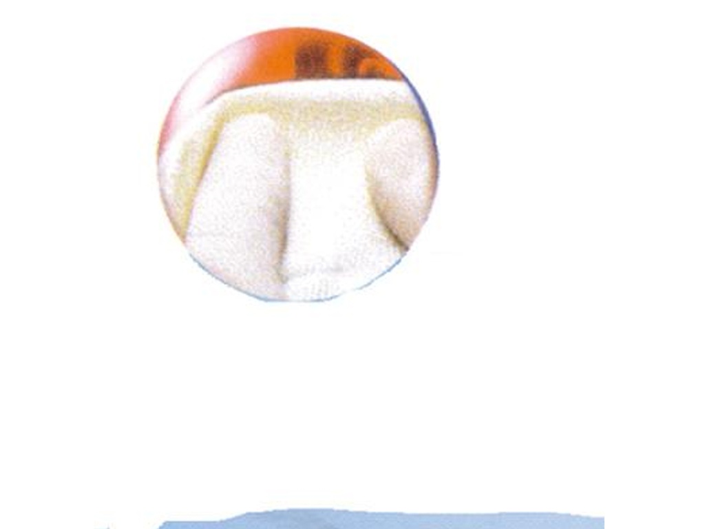 Surgicel Nu-Knit 12 u. 2,5cm x 2,5cm - Johnson&Johnson