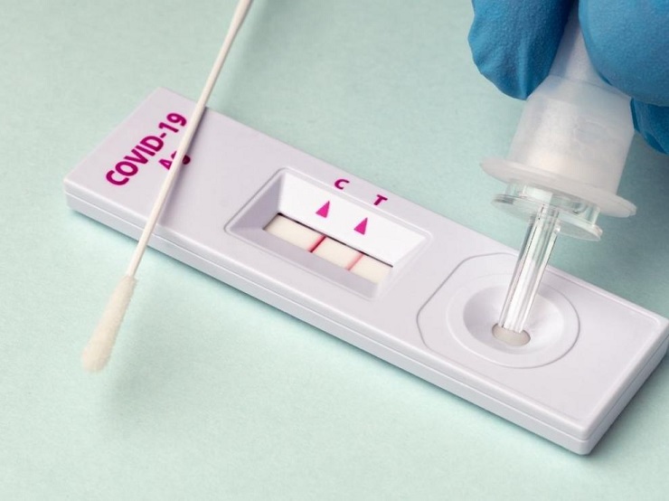 Test Antigenos Covid-19 Autodiagnóstico 5U